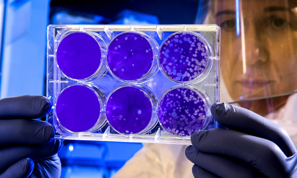 Scientist examines the result of a plaque assay